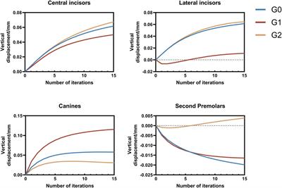 Effects of different intrusion patterns during anterior teeth retraction using clear aligners in extraction cases: an iterative finite element analysis